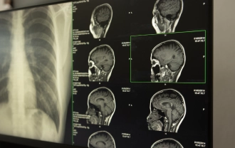 Desktop Brain Injuries PA