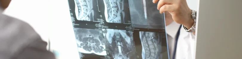 Spinal Cord Injury Attorney in Lexington, SC