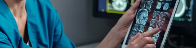 Lexington, SC Traumatic Brain Injury Lawyers