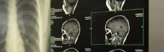 Mobile Brain Injuries PA