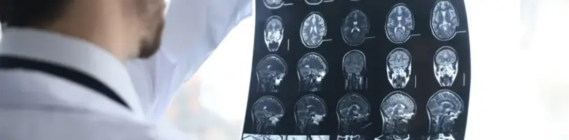 Traumatic Brain Injury Attorneys in Rock Hill, South Carolina